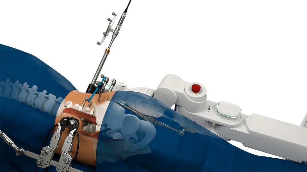 Robotic Surgery