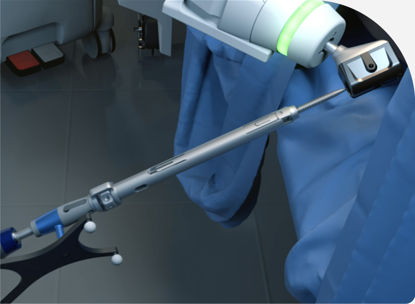 Robotic Surgery