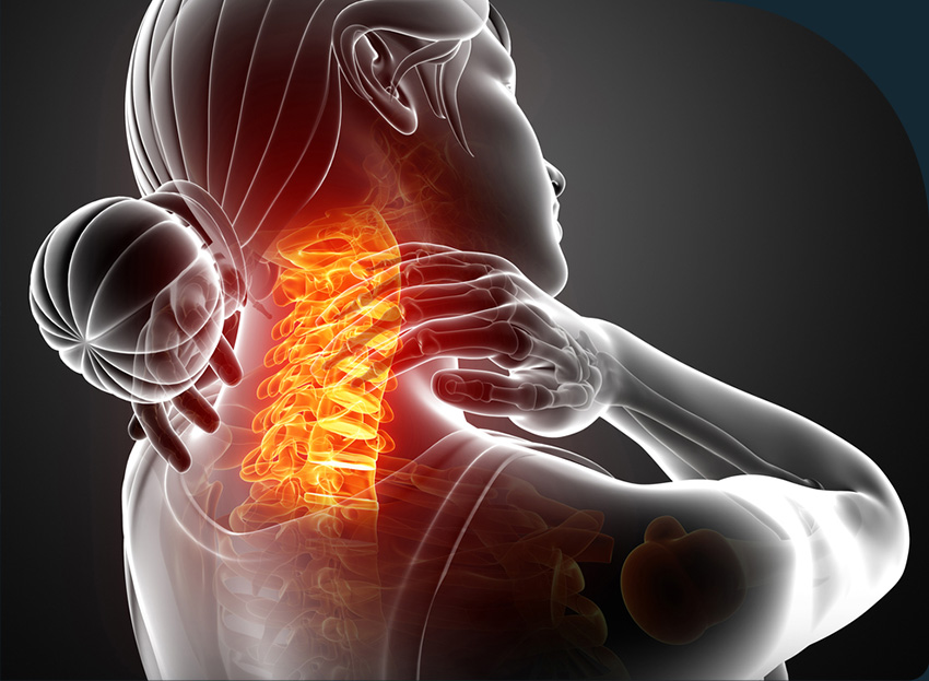 Neck Pain: Causes & Treatment